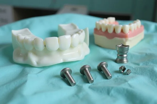 All-on-4 / All-on-6 Dental Implants gallery image 4